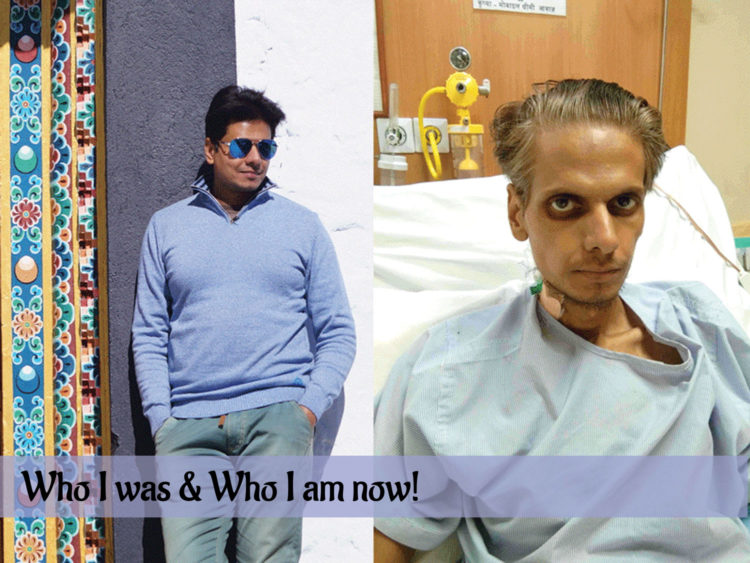 Before and after